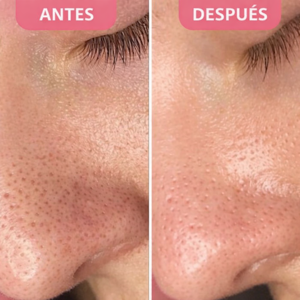 Moonlise - Sérum Exfoliante De Arroz Negro