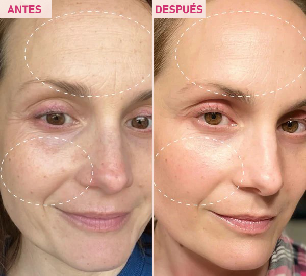 Sérum Facial The Vita-A Retinal Shot Tightening Booster