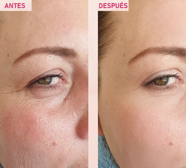 Sérum Facial The Vita-A Retinal Shot Tightening Booster