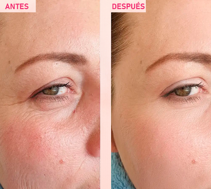 Sérum Facial The Vita-A Retinal Shot Tightening Booster