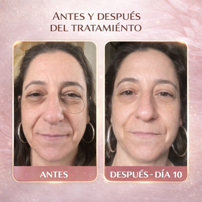 CREMA CON LUZ INFRARROJA PARA CONTORNO DE OJOS